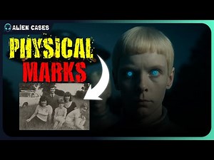 🛸Family's Shocking ALIEN ABDUCTION (1978): The Physical Proof