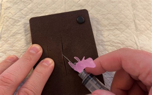 【局部麻醉注射】Injecting Local Anesthetic - Quick Demo in HD!