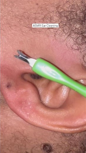 Ear piercing hole cleaning #asmrearcleaning
