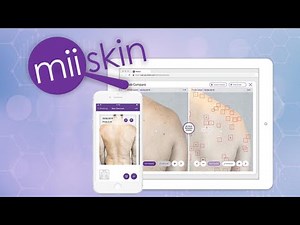 New app uses AI and ML to monitor changes in skin to prevent cancer