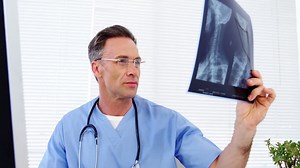 Male doctor examining an x-ray | Free Stock Video Footage