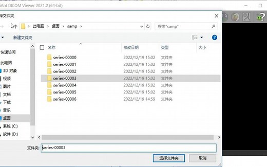 RadiAnt DICOM Viewer 2021 医学影像浏览看图软件 免费安装包下载安装,全网最全面的