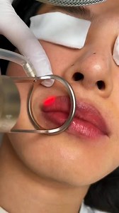 2.3K views · 84 reactions | Lip care tips  #lip #lipstik #lipcare #lipgloss #glossylips #tips | Wellbeing Tricks | Facebook