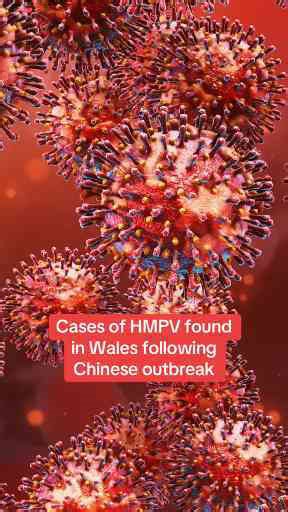Cases of HMPV Found in WALES Following Chinese Outbreak