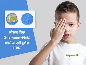 जानिए बच्चों से जुड़ी दुर्लभ और आनुवांशिक बीमारी नीमन पिक (Niemann-Pick) के बारे में