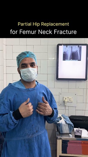 Partial Hip Replacement for Femur Neck Fracture | Orthopedic Surgeon Explains