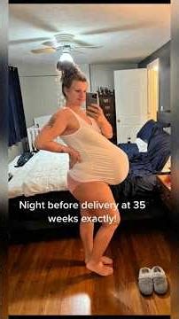 How She Carried TRIPLETS to 35 Weeks: Alice's Miracle Journey 🙏 #shorts #MiracleBabies #TripletMom