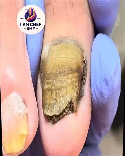 29K views · 230 reactions | Smart Ways to Maintain Dry Cuticles For Long-Term Comfort #NailCareTips #CleanNailsDaily #ToenailRoutine #HealthyNails | I am Chef Shy | Facebook