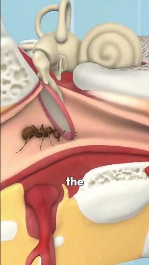 "What if a ant crawls into your ear"? 🐜🤢