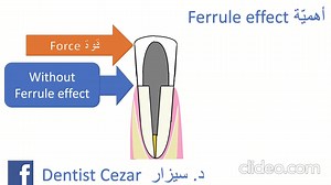 3.4K views · 214 reactions | #دقيقة: من الضروري ابقاء جزء كافي من...