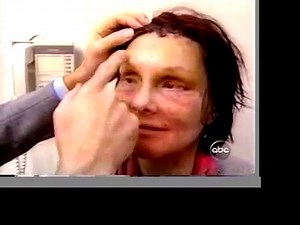 Confessions of an Extreme Makeover Plastic Surgeon