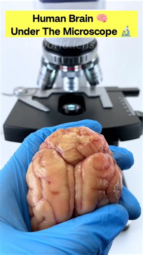 इंसान का दिमाग़ under the microscope 🤯🔬 #shorts #youtubeshorts #facts #microscope #millionaire #fun