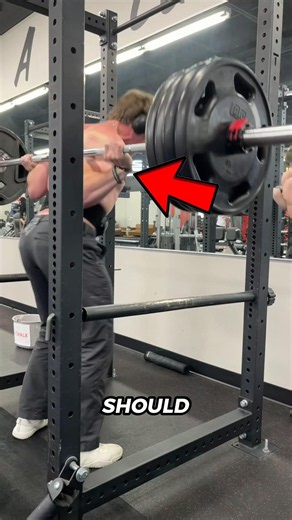 Think You Broke a Bone? Don’t Make This Mistake