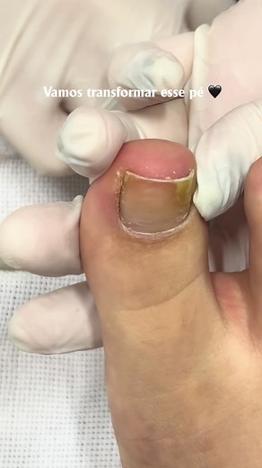 Unhas Perfeitas: Inspiração e Transformação
