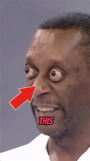 Bro His Eye Popped Out😱 #shorts