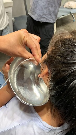 Earwax removal 706 #reels #reelsfb #reelsviral #reelsvideo | Doctor Earwax III