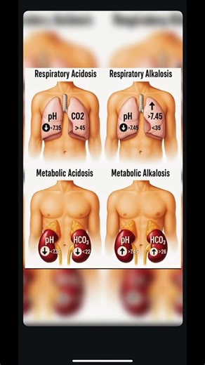 Understanding the basic of acid base balance is crucial ?#ytshorts #shortsviral #doctor #medivibe