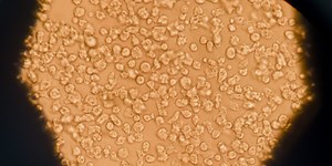 Ancient ‘zombie’ viruses may threaten humans due to global warming, scientists say