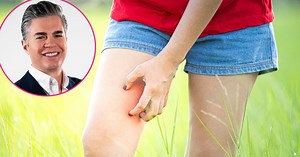 How to Heal and Prevent Skin Chafing: 5 Expert Tips