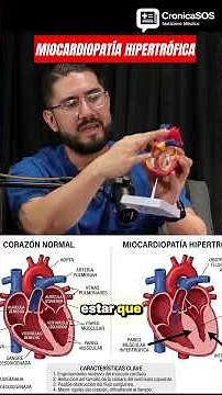 🚨 Hypertrophic Cardiomyopathy. This is what happens to the heart #clinicasos #health #news #croni...