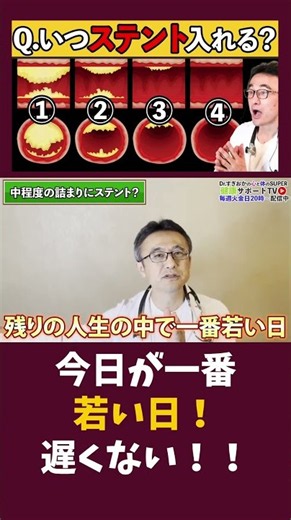 ステント手術せずプラーク改善【動脈硬化】心臓のステント治療メリットと危険性を正しく理解しよう！循環器内科医が解説 #すぎおかクリニック #船橋市