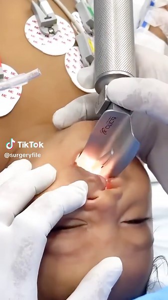 Cleft Baby Surgery: Insights from an Anesthesiologist