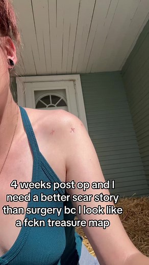 Shoulder Surgery Scars: 4 Weeks Post-Op