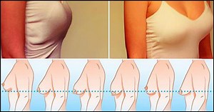 5 Effective Ways On How To Prevent Breast Sagging After Pregnancy