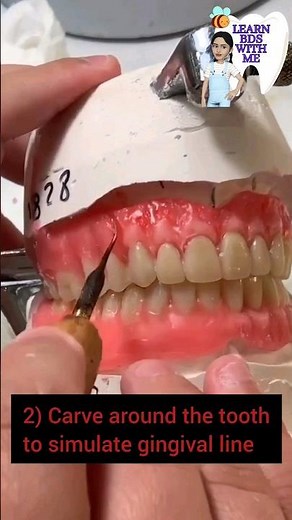 Complete dentures - Making them beautiful