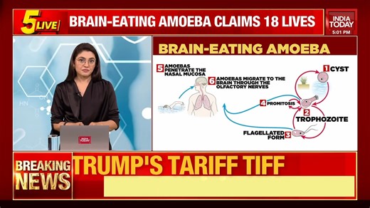 4.8K views · 33 reactions | Kerala brain-eating amoeba alert! Watch as Sonal Mehrotra Kapoor explains what the brain-eating amoeba is, how it attacks the brain, how it infects humans, and more. | India Today | Facebook