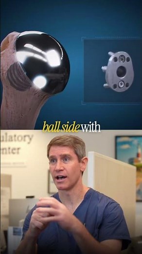 Anatomic vs Reverse Shoulder Replacement… what’s the real difference? Dr