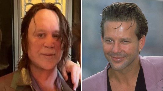 Mickey Rourke before and after: His plastic surgery transformation explained