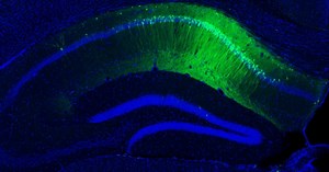 Aging Brain Initiative