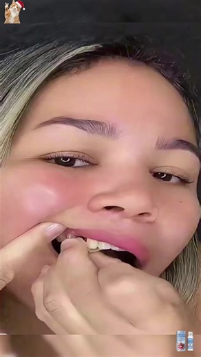 Three Steps to Fix a Missing Front Tooth