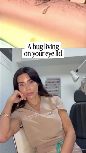 The Tiny Bugs Living on Your Eyelashes (Demodex Explained)