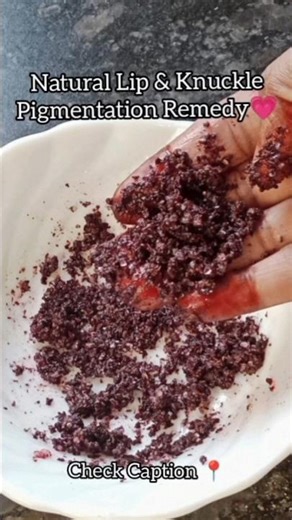 Natural lip & knuckle Pigmentation Remedy 💗 #youtubeshorts #shorts #short