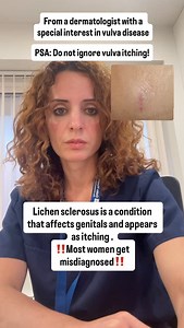 Symptoms of lichen sclerosus include: ‼️ itchy white patches around the genitals or anus that may bleed if scratched. There are some things you can do to help ease the symptoms of lichen sclerosus, including using an emollient soap substitute instead of regular soap. 🌟There’s no cure for lichen sclerosus, but you can ease symptoms with prescription treatment. #lichensclerosus #vulvaitch #womenhealth #dermatologistrecommended #riversideskinandlaserclinic | Riverside Skin & Laser Clinic