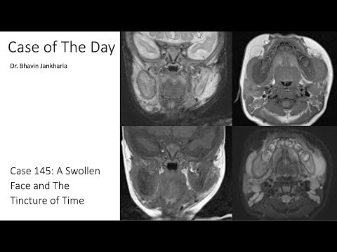 Case of the Day - 145 - A Swollen Face and The Tincture of Time