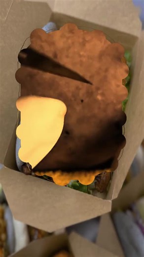 #sqeezeyuk #acne #pimplepop #satisfying #relax #fyp #blackhead #squeeze #pimple #skin