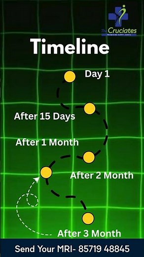 ACL Surgery Recovery Timeline | Full Comeback in Months 🏃‍♂️ | The Cruciates