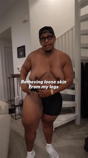 November 11 is the big day for my surgery. I’ll be heading back to the doctor one more time before then, so drop your questions in the comments. Don’t be nervous, don’t be shy there’s no such thing as a dumb question. I make these videos to give you the info you need, whether you’ve already made the same mistakes I did (and want to know how to fix them) or you’re trying to avoid them in the first place. Hopefully, these videos help you stay on track and stop the weight from creeping back. #weigh