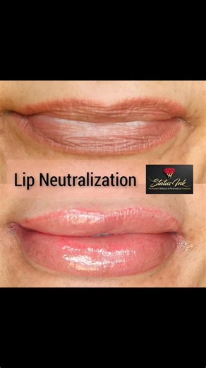I'm excited to share information about lip neutralization with you all today! 👄 This procedure is designed to even out lip color and correct any discoloration, offering a natural and balanced look. 🤔 I find the process fascinating as it involves using specialized techniques to neutralize unwanted tones, ultimately creating the perfect canvas. I am confident that the results can be transformative, providing my clients with a boost of confidence and enhanced beauty. ✨ If you're curious to learn 
