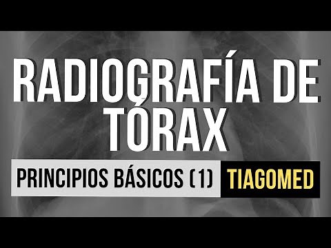 RADIOGRAFÍA DE TÓRAX - Principios básicos (Parte 1)