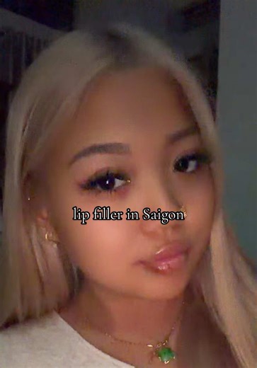 Walking up the stairs in that heat almost took me out 😭 but anyway… I love it here. They speak both English and Vietnamese, so communication is easy. What really stood out to me is how honest they are about what you actually need. She literally told me I didn’t even need filler because my lip shape was already nice 😭 I just wanted a small correction, so she suggested only 0.5ml instead of overdoing it. I already had a bit of Teosyal from about 3 years ago and decided to try Revolax this time, 