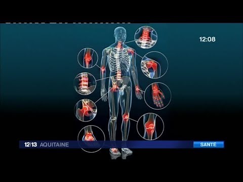 Quels solutions pour soulager les douleurs liées à l'arthrose ?