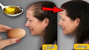 103K views · 1.2K reactions | Mix eggs with olive oil for Double Hair Growth - How to Grow Long Thick Hair naturally #hairgrow #hairgrowth #longhair #thickhair | YourBeauty Tv | Facebook