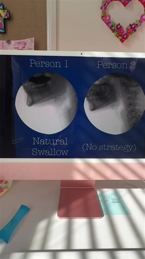 Effective Strategies for Learning Dysphasia