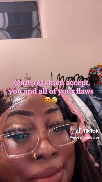 #stitch with @Amputee girl 8 of my fingers were amputated due to infection from my burns. I love seeing videos like this😍Someone who loves you for you is EVERYTHING🙌🏾🥰❤️ #ilovelove #survivor #fyp