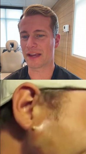 Juicy cyst explosion!! #juicy #explosion #fyp #cyst #satisfying #pimple #pimplepop #satisfyingvideo