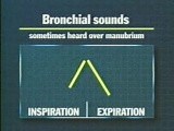 Review Of Breath Sounds • Video • MEDtube.net